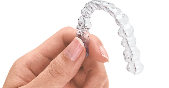 invisalign