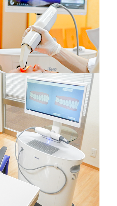i-Tero スキャニング 光学デジタルスキャニングカメラ